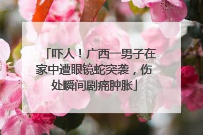 吓人！广西一男子在家中遭眼镜蛇突袭，伤处瞬间剧痛肿胀